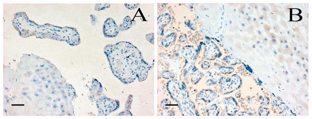 26. ábra Kannabinoid receptor 1 (CB1)-specifikus festődés normális (A) és praeeclampsiás (B)