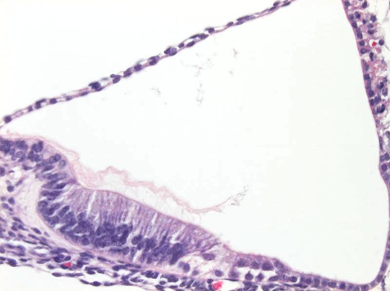 Fejlődőcochlea scala vestibuli membrana vestibularis stria vascularis scala media / ductus