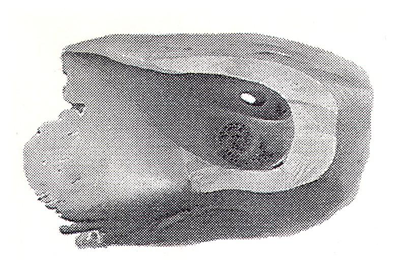 NERVUS