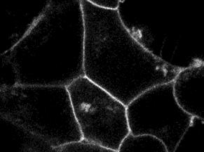 függetlennek találtuk, a 28. ábrán bemutatott kísérletet elvégeztük úgy is, hogy az AT 1 R-t fluoreszcens ligand helyett β-arresztin 2-YFP segítségével tettük láthatóvá.