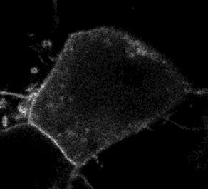 Az egyesített képen csak a GFP-klatrin (zöld színnel), és a Rhod-Ang II látható (piros színnel).