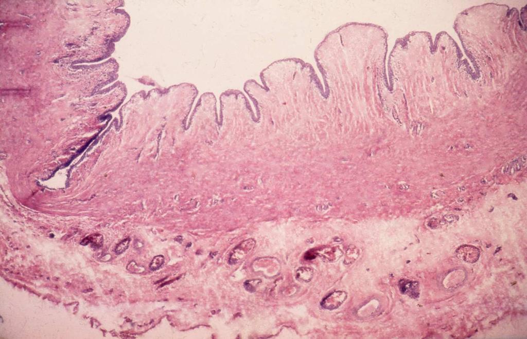 Human Ureter: pars abdominalis Urothelium Lamina propria mucosae
