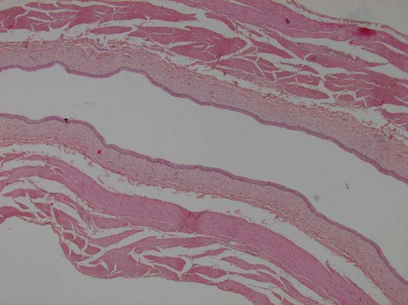 Vesica urinaria / Urocysta urothelium lamina muscularis mucosae