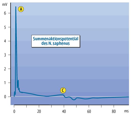 A kevert perifériás ideg compound akciós potenciálja Proximális (centrális) n.