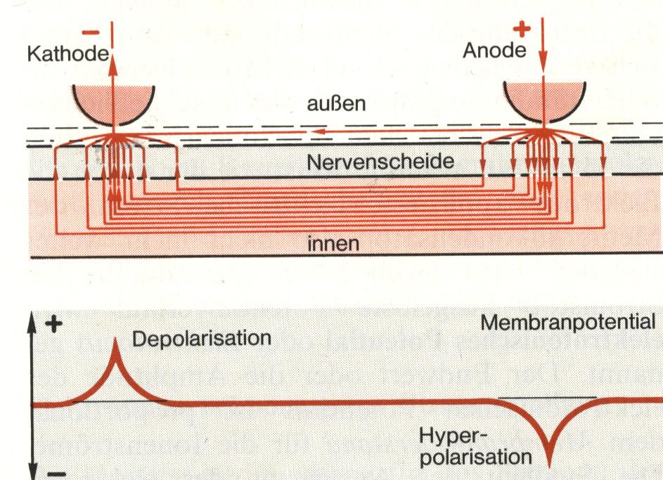Extracelluláris ingerlés: Katód membrán depolarizáció (katelektrotónus) Anód membrán hiperpolarizációja (anelektrotónus) katód ECF membrán ICF anód Felhasználás a gyógyászatban: Kamrai tachycardia
