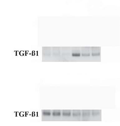 3. ÁBRA. Miokardiális génexpressziós változások. b: Az endogén antioxidáns szuperoxid dizmutáz 1 (SOD1) és 2 (SOD2), kataláz, glutation reduktáz és tioredoxin génexpressziója.