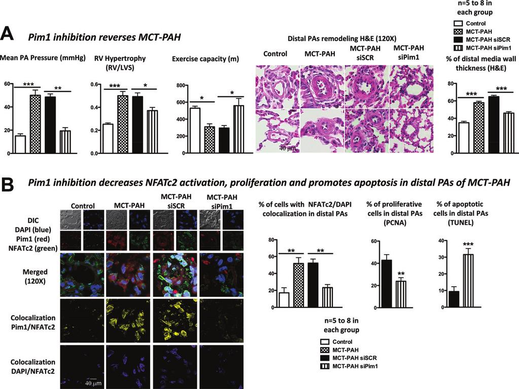 Paulin et al Pim1 Inhibition Reverses Pulmonary Hypertension 1211 Downloaded from http://circ.ahajournals.
