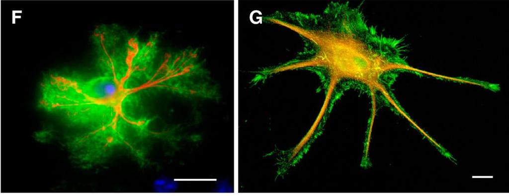 Asztrocita GFAP/GFP in vivo GFAP/ezrin in vitro