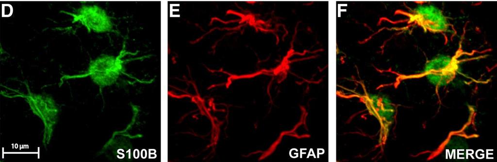 - Asztrociták szekretálják is - patológiás esetekben keringésbe is kijut: esetleg diagnosztikában használható (screening) for determination of CNS injury at the molecular level before gross changes