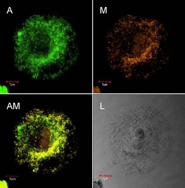 7-24. Ábra MsOxprot-HA túltermelő Arabidopsis protoplaszt immunfestése.