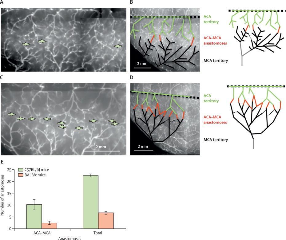 Figure 2 Cortical pial collaterals between ACA and MCA vessels in C57BL/6J mice with robust collaterals versus BALB/c mice with fewer collaterals (A, C) The pial anastomoses are identified by arrows.