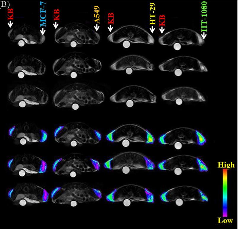 MRI Jelzés NMR aktív nuklid (MRI) - pl.