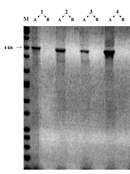 Long PCR a CYP11B1CYP11B2 fúziós gén