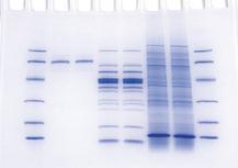 A fehérjék vizsgálata Western blot segítségével