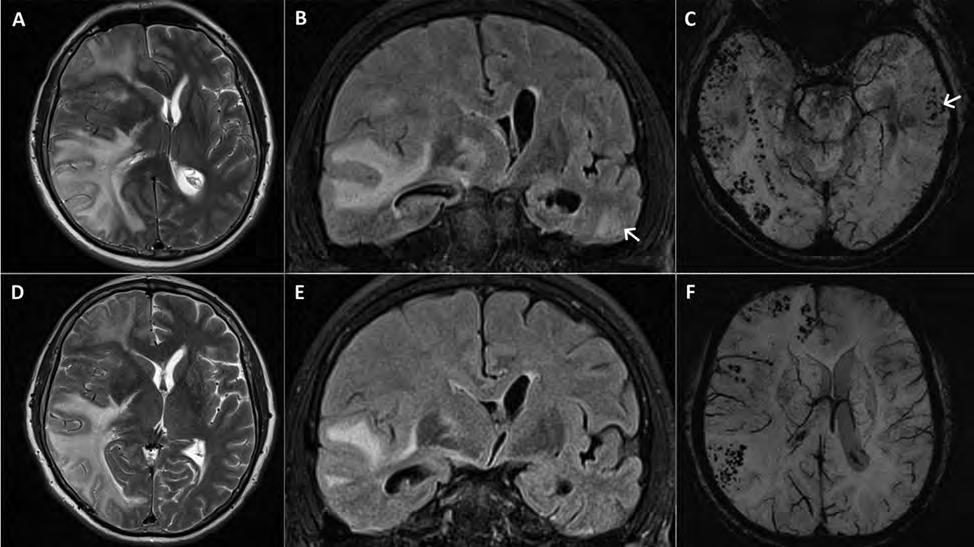 Figure 2. Initial CT and MRI images.