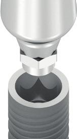 Implantátum Rendszer Az Eco-plant rendszer