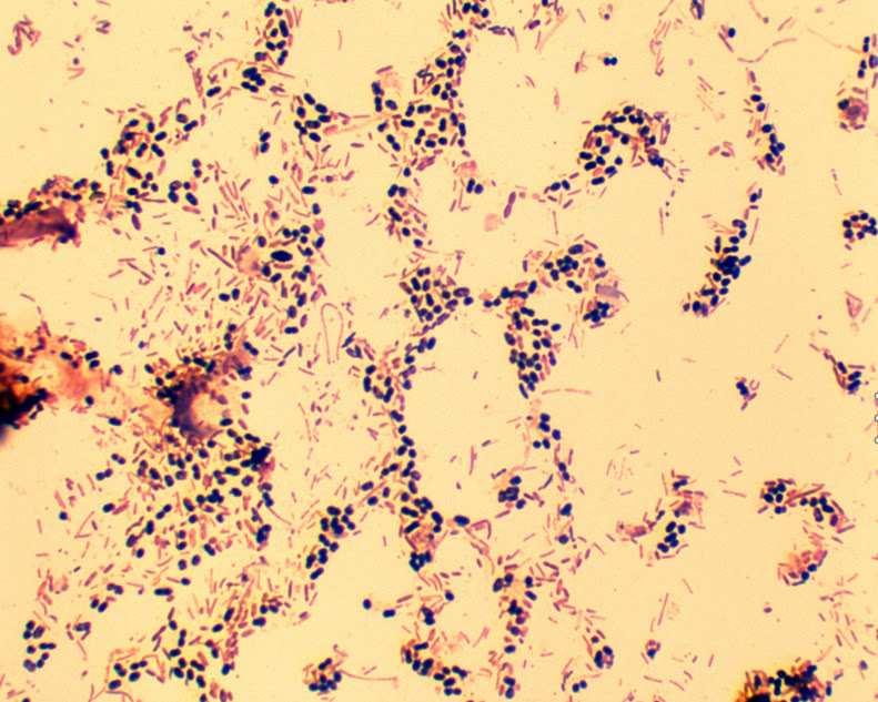 TGM: AEROB DYSBACTERIOSIS Hasmenés Normál
