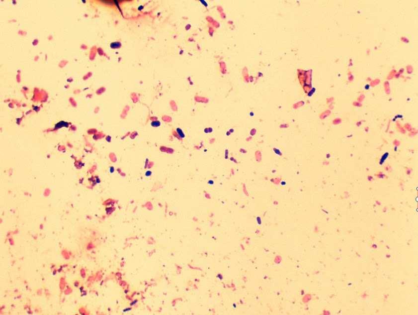 TGM: GYÉR NORMÁL FLÓRA, ANAEROB DYSBACTERIOSIS Hasmenés, romló kondíció.