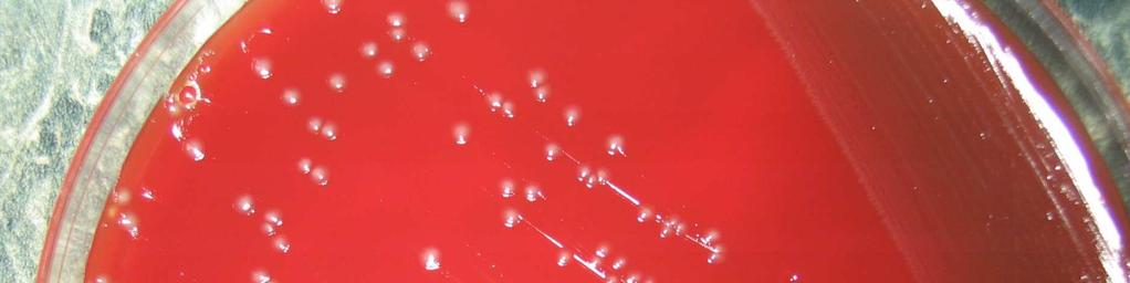 PASTEURELLA