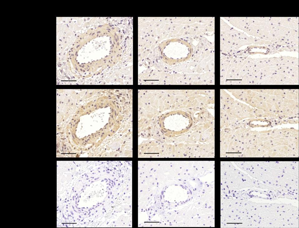 4.2 In vitro kutya koronária vizsgálatok eredményei 4.2.1 Immunhisztokémia A kutya bal kamrai szívizom-metszetek GHS-R1a festődését az 1. ábra felső sora mutatja.
