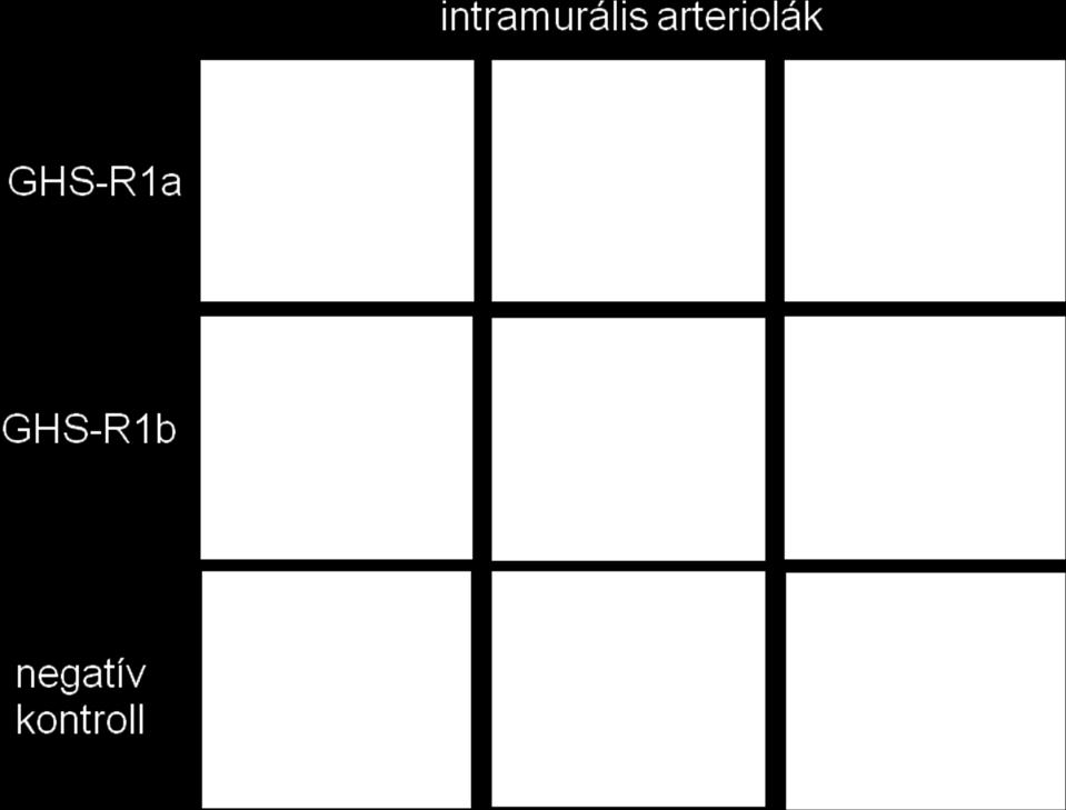 A metszetek GHS-R1b immunfestését az ábra középső sora mutatja. A miokardiális GHS-R1b immunpozitivitás az 1a receptor altípusénál kifejezettebbnek bizonyult.