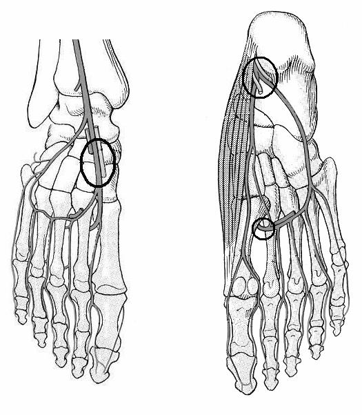 49 4) Rete arteriosum a) Rete arteriosum articulare coxae: trochanter és cruciate anastomosis (4+2 ág) Fő értörzs Anastomisaló ágak Fő értörzs A. iliaca a. circumflexa a.