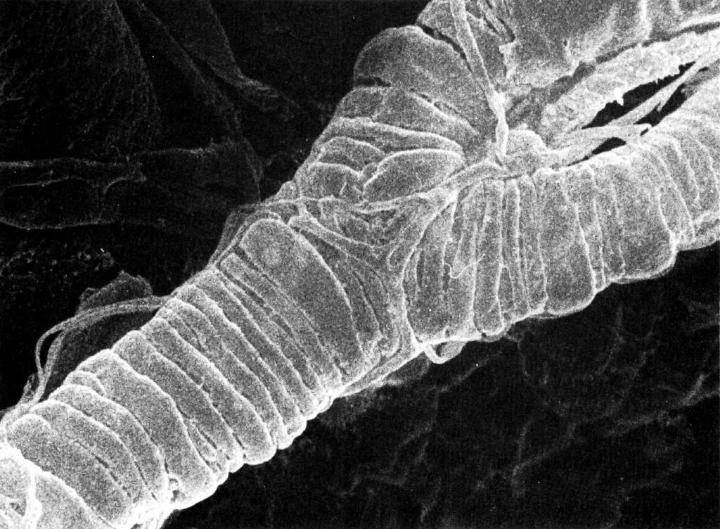 Arteriola scanning