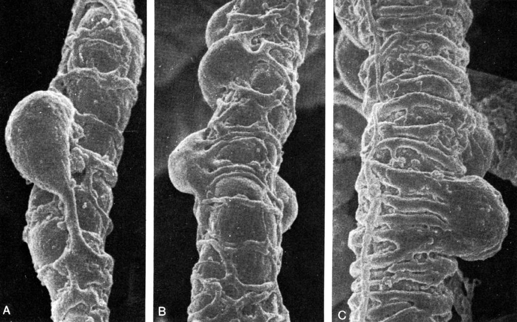 Kapillárisok (A,B) és s arteriola (C) pericitákkal (P): scanning EM kép.