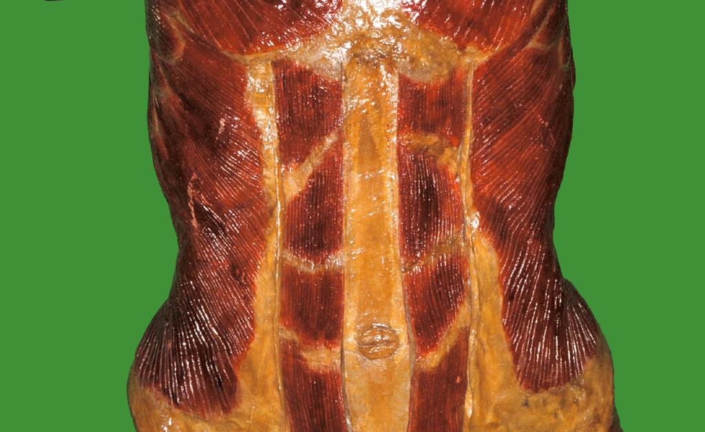 Közbeiktatott inas szakaszok izomban (musculus rectus abdominis).