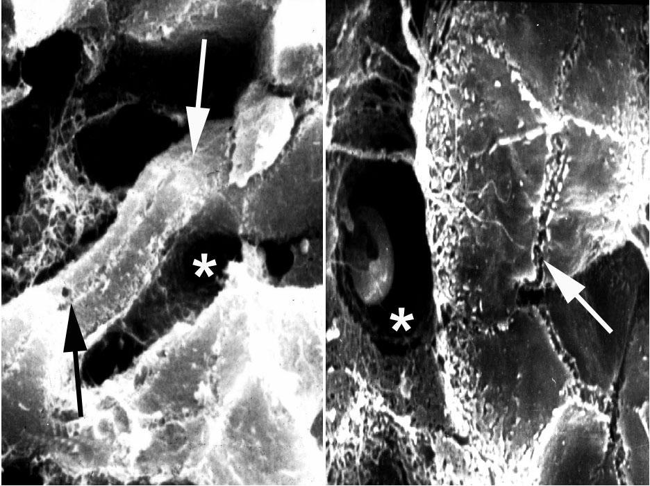 Hepatocyta-trabecula, a nyíl az epecapillarisra mutat, mely végigfut a felszínen hepatocyta