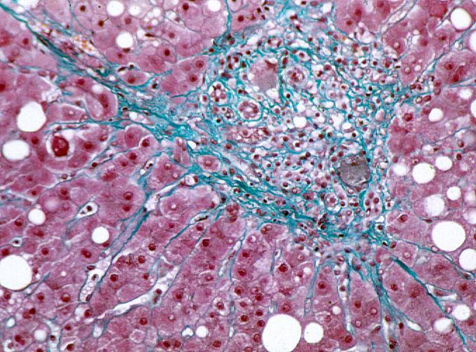 septa F3 = Septal