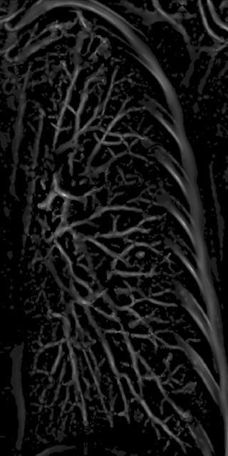 vessel