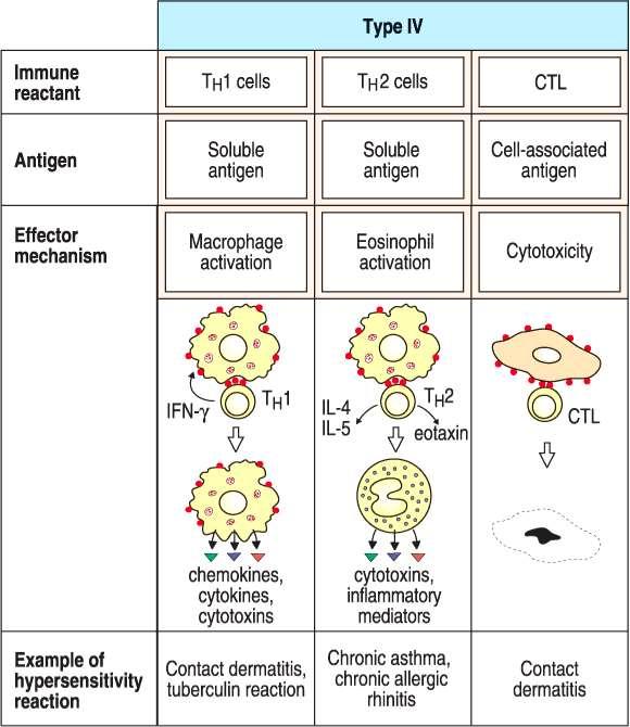IV-es típusú túlérzékenységi reakció IV Típus Immun sejt Th1 sejt Th2 sejt CTL Th1 sejt: DTH-sejt, vagy T DTH (Delayed Type Hypersensitivity) Antigén Effektor mechanizmusok Szolubilis antigén