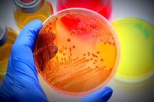 Bélfertőzések Acute Intestinal Infections A.I.I. ( Acute Intestional Infections) Real-TM (Katalógusszám: B45-50FRT) Shigella spp., E.coli, Salmonella spp., Campylobacter spp.