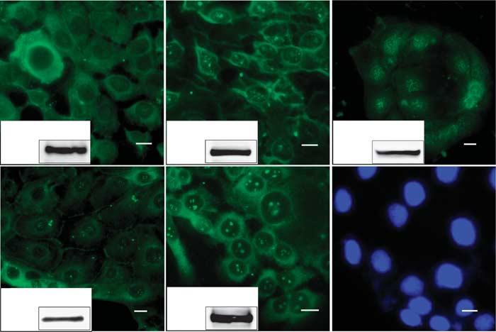 TGéczy et al. PKC Isoforms Regulate Human Sebocyte Biology Intriguingly, we lack data on the functional role of the PKC system in the other component of the human pilosebaceous unit, i.e., the sebaceous gland and its sebocytes.