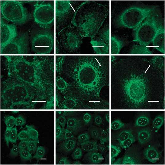 TGéczy et al. PKC Isoforms Regulate Human Sebocyte Biology a Control PMA AA cpkcα npkcδ apkcζ b Control AA 50 μm PMA 10 nm Days in culture: 1 2 3 1 2 3 1 2 3 OD (%) 100 100 100 122 93 91 36.4 5.9 4.