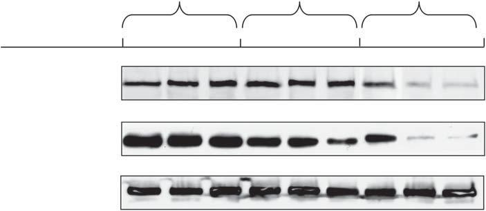 Phorbol 12-myristate 13-acetate (PMA) and arachidonic acid (AA) differentially translocate and downregulate certain protein kinase C (PKC) isoforms in SZ95 sebocytes.