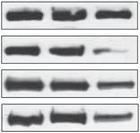 Conventional protein kinase Ca (cpkca) and novel protein kinase Cd (npkcd) are involved in mediating the lipogenic action of phorbol 12-myristate 13-acetate (PMA), whereas short interfering RNA