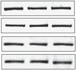 Various sirna probes against PKC isoforms, as well as a scrambled sirna probe (Scr. si), were introduced into cells by transfection.