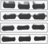 As controls (C), the effect of the transfection reagent was determined. As a housekeeping molecule, expression of cytochrome-c (Cyt-C) was assessed.