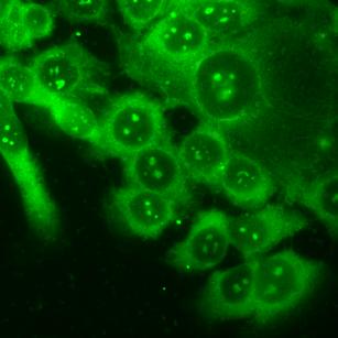 Immuncitokémia, Western blot valamint kvantitatív real-time PCR segítségével (az irodalomban először) sikerült