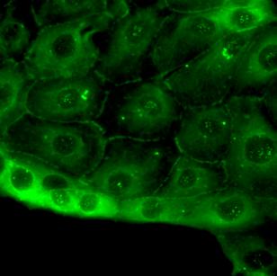 PKCζ kifejeződését mind protein, mind pedig mrns szinten (5. és 6. ábra).