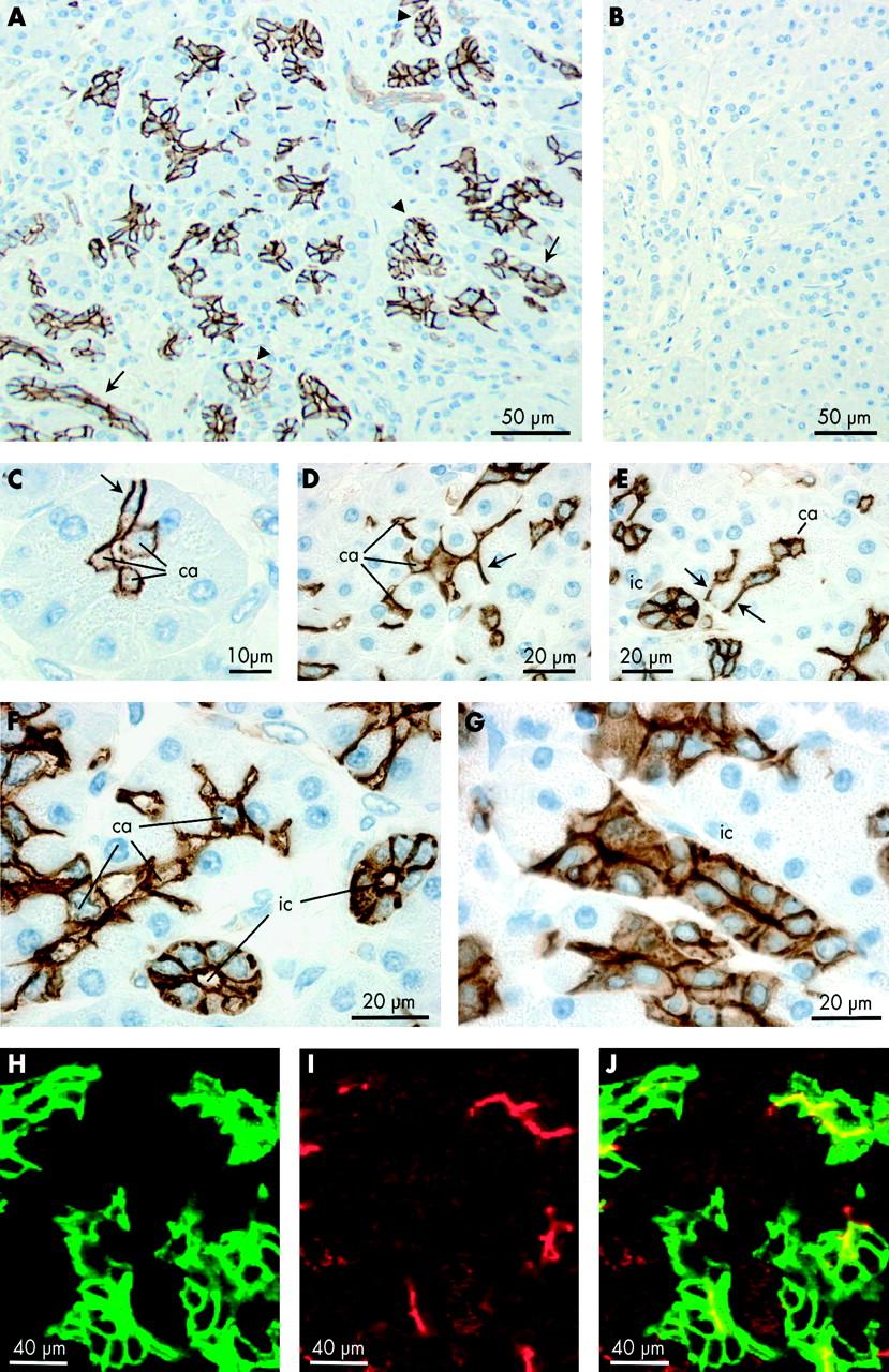 17. ábra: Az akvaporin 1 (AQP1) immunlokalizációja centroacináris és interkaláris duktuszsejtekben emberi hasnyálmirigyben (Dr. Burghardt Bea munkája).