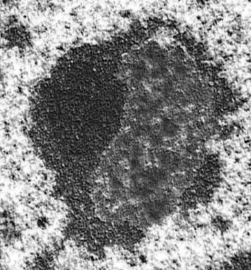 Pars amorpha: kevésbé elektrondenz fibrilláris centrum, realtíve laza szerkezetű, rdns-t tartalmaz (rrns-t kódoló gének) Pars fibrosa: erősen elektrondenz fibrilláris komponens.