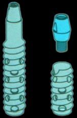 Straumann implantátumok fejlődése 1980/82