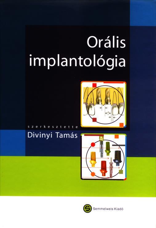 Az ITI Straumann Implantációs rendszer világszerte ismert, és a Brånemark rendszer után talán a második legelterjedtebben alkalmazott szisztéma.