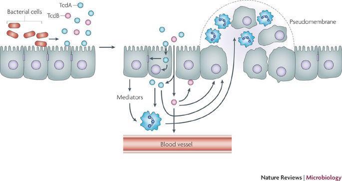 PSEUDOMEMBRANOSUS COLITIS RIZIKÓFAKTOROK: ANTIBIOTIKUM HASZNÁLAT HOSPITALIZÁCIÓ PPI, ANTIDEPRESSZÁNS HASZNÁLAT IDŐS KOR LEGYENGÜLT IMMUNRENDSZER MEGELŐZŐ VASTAGBÉL BETEGSÉG: IBD, CRC HASI