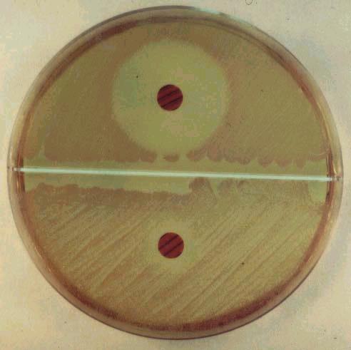 4. S. epidermidis (É) és S.