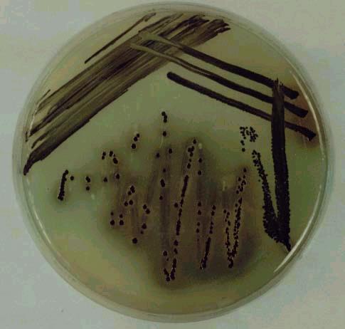 13. Salmonella