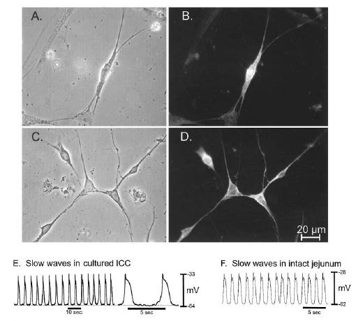 sejtekben (interstitial cells of Cajal, ICC).